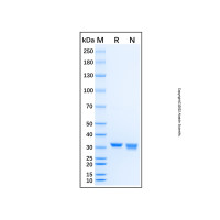 Recombinant Human POLL Protein,无载体,His标签,≥95%(SDS-PAGE),expressed in E. coli; 见COA,阿拉丁