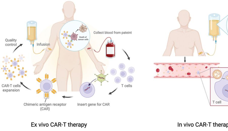 In vivo CAR-T正在颠覆癌症治疗的游戏规则 —— ASGCT 2026大会 in vivo CAR-T技术进展全景扫描