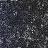人B淋巴细胞瘤细胞（FLUC标记）RAMOS-FLUC-puro
