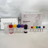 人（Human）基质金属蛋白酶3（MMP-3）ELISA检测试剂盒