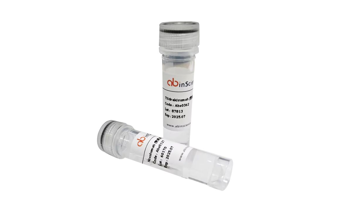 武汉艾必赛生物有限公司推荐Anti-BDBV Nucleoprotein Antibody (SAA2994) ,精品抗体