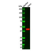 RRM2 Antibody,ExactAb™, Validated, 0.2 mg/mL,阿拉丁