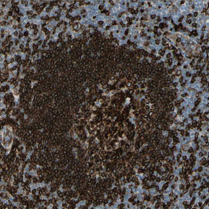 Altas Antibodies热销产品推荐:Anti-CD74 Antibody(货号HPA010592) Altas Antibodies热销产品推荐:Anti-CD74 Antibody(货号HPA010592)