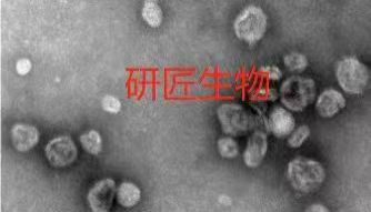 外泌体实验总失败？样本/提取/鉴定/功能实验四大翻车坑，一次性讲透