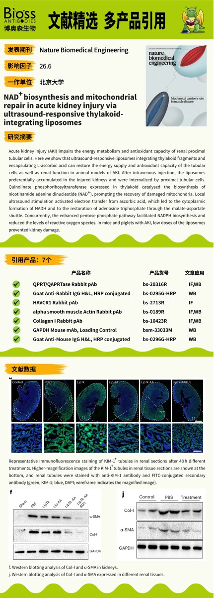 Bioss抗体助力AKI修复新策略：超声响应叶绿体脂质体介导的NAD+合成与线粒体再生