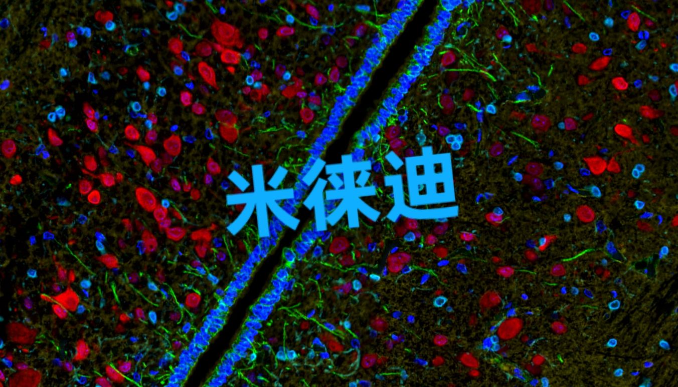 TSA多色荧光技术服务