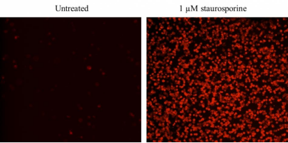 Annexin V 进阶指南：染色后能固定吗？TUNEL有啥区别？