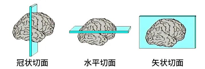 动物病理取材怎么切?一文看懂纵切vs横切|超实用科普-公司新闻-深圳灵赋拓普生物科技有限公司