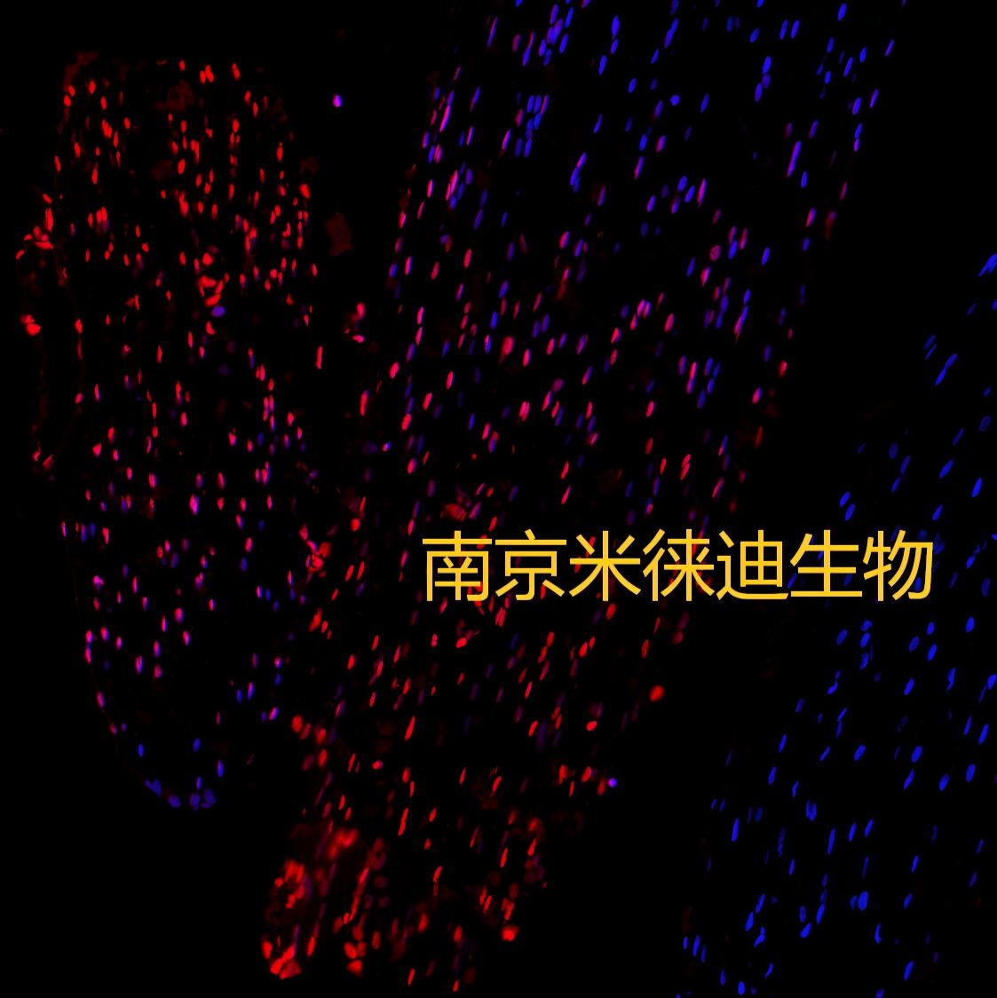一步法TUNEL试剂盒,把‘省心’写进说明书里