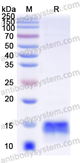 AntibodySystem蛋白抗体 | Recombinant Human PTH Protein, C-His：骨代谢与钙磷调控研究核心蛋白