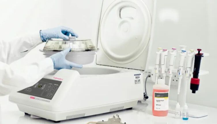 文献速递|Cytospin涂片免疫染色在肿瘤生殖学领域的应用（二）
