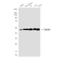 TSG101 Rabbit Monoclonal Antibody1