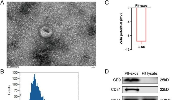告别关节疼痛？《Chemical Engineering Journal》重磅研究：血小板外泌体或成骨关节炎克星