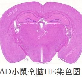 阿尔茨海默病动物模型