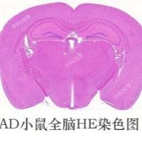 阿尔茨海默病动物模型