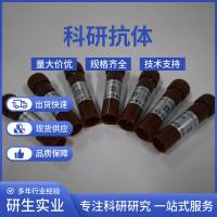 NK细胞受体/自然杀伤细胞活化性受体