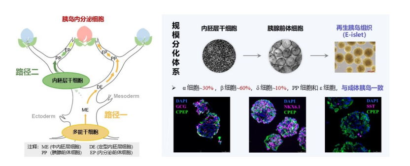 我国实现再生胰岛移植-糖尿病治疗新路径!