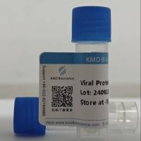 Recombinant SARS-CoV-2/COVID-19 RBD Protein (E484K)，His Tag