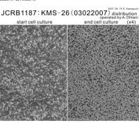 JCRB1187 KMS-26(血淋巴细胞癌细胞系)