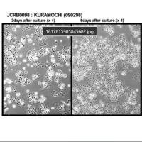 JCRB0098 KURAMOCHI（人卵巢癌细胞系）