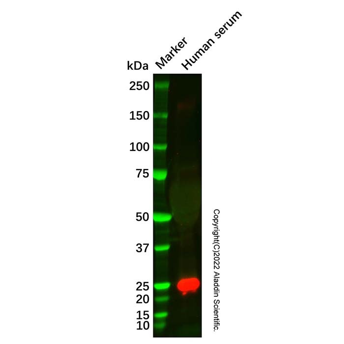 Recombinant ApoM Antibody,ExactAb™, 已验证, 重组, Lot by Lot,阿拉丁