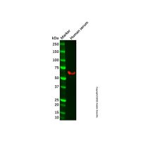 Recombinant Tissue Plasminogen Activator Antibody