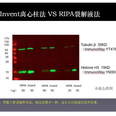 Minute™ 动物细胞/组织总蛋白提取试剂盒