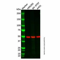 Recombinant RGS9 Antibody,ExactAb™, 已验证, 重组, 高性能, 见COA,阿拉丁