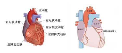 心梗动物模型怎么选？PL 结扎 VS I/R 缺血再灌注