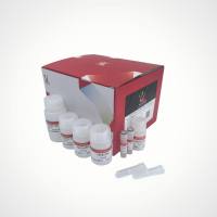 采血卡DNA提取试剂盒(不含RNase A)-微量干血斑/血卡DNA提取