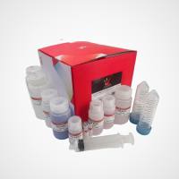 无内毒素质粒DNA超大量提取试剂盒（100-500ml）-快速去内毒素 | 可视化操作 | 超大容量过滤柱 | 转染级高纯度质粒