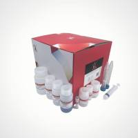 无内毒素质粒DNA中量提取试剂盒(30-50ml)