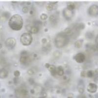 hPSC诱导分化胰腺类器官