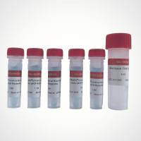 YALEPIC® 通用型示踪高灵敏 qPCR 预混液（染料法）| 蓝色示踪