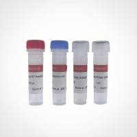 YALEPIC® All-in-Mix cDNA 第一链合成试剂盒（gDNA off）|  预