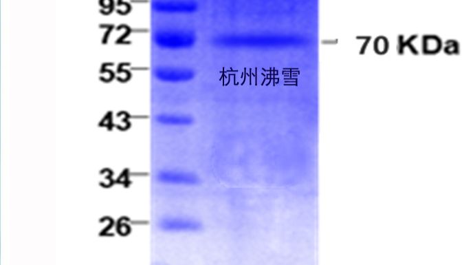 杭州沸雪 Frostgen®供应重组猪伪狂犬病毒gB真核蛋白；PRV-gB抗原；猪伪狂犬抗原
