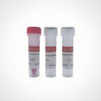 All-in-RT RedMix (gDNA off) | 一步法去gDNA 全预混 红色示踪