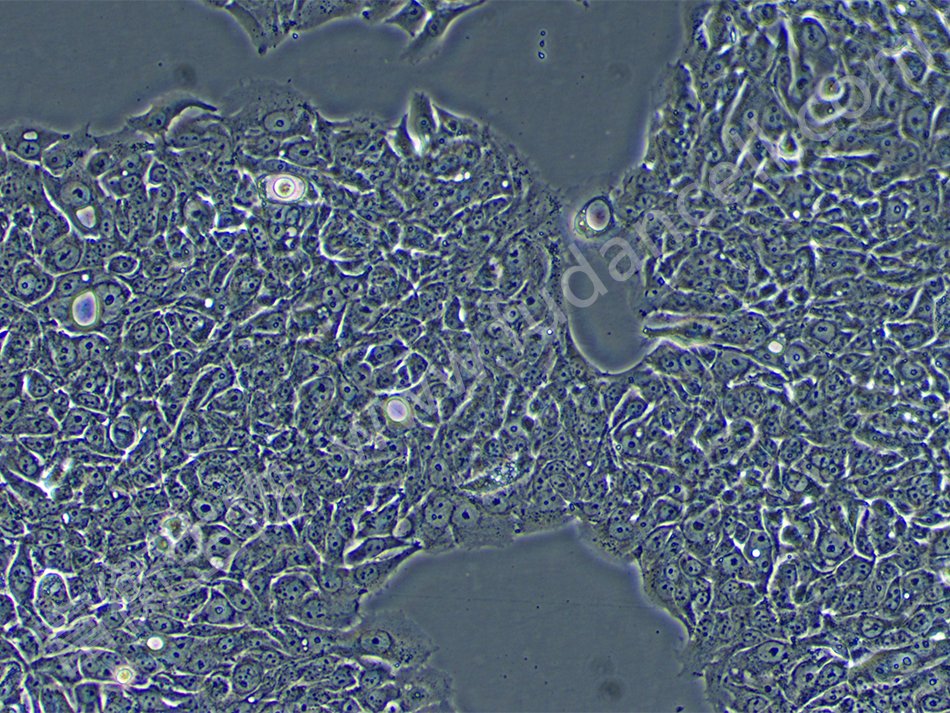 NCI-H358人非小细胞肺癌细胞系(STR鉴定正确).jpg
