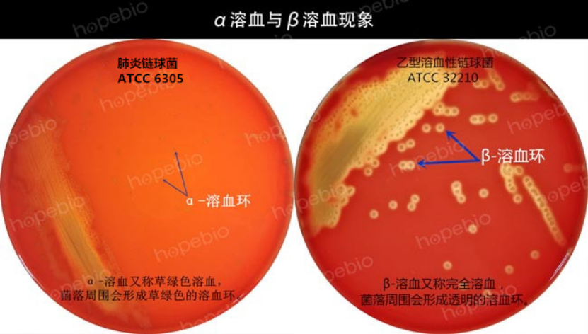 血琼脂培养基基础的选用和平板制作注意事项
