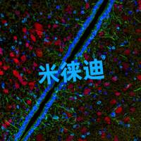 多重免疫荧光染色服务