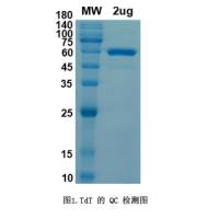Terminal Deoxynucleotidyl Transferase