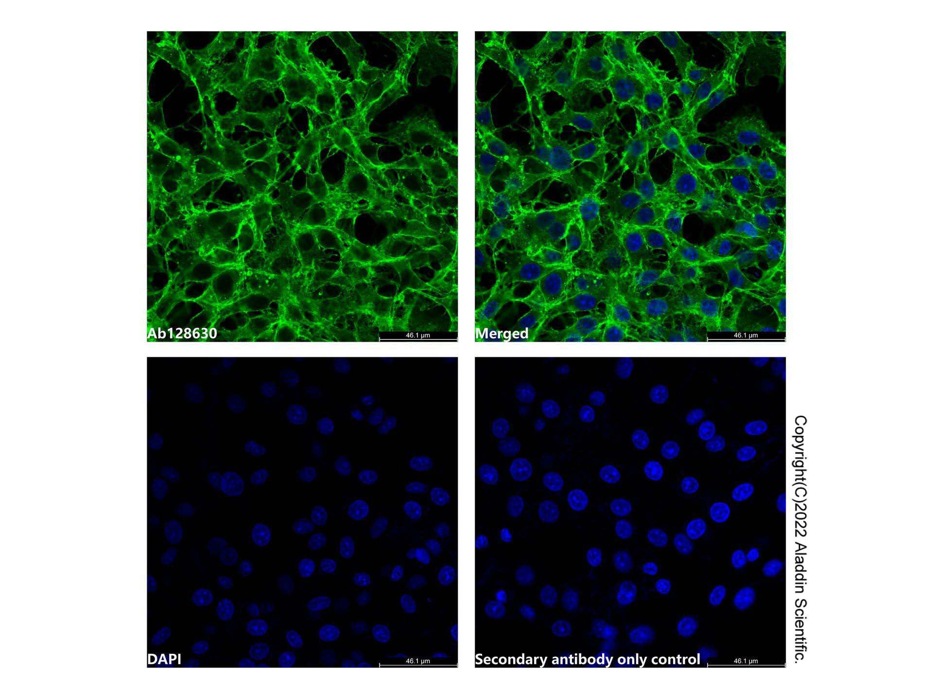 Recombinant Sodium Potassium ATPase/ATP1A1 Antibody,ExactAb™, 重组, 已验证, 高性能, 见COA,阿拉丁