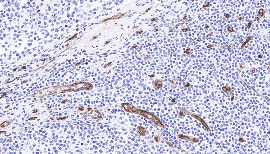 CD34抗体如何鉴定造血干细胞与血管内皮？