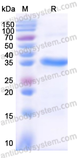AntibodySystem蛋白抗体|Recombinant Human C9 Protein, N-His：补体终末成分与膜攻击复合体研究核心蛋白