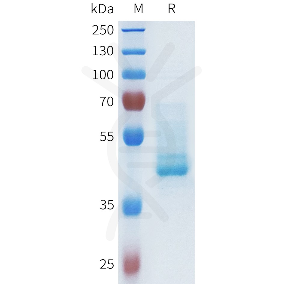 pme101631-cdh1-sp1.jpg
