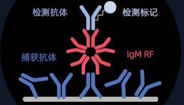 【行业趋势】IVD全球去动物源化浪潮下，免疫检测干扰阻断剂如何升级？迈迪安给出完整答案