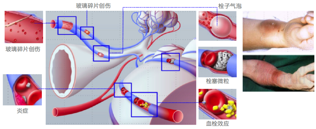 5月广州见！Pall Medical 邀您共话血液病质控新进展