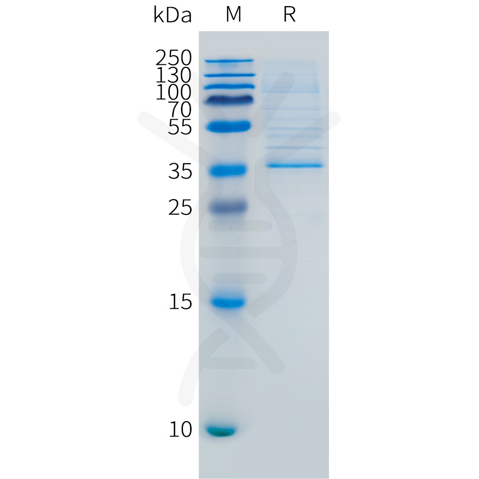 pme101539-ly6e-sp1.jpg