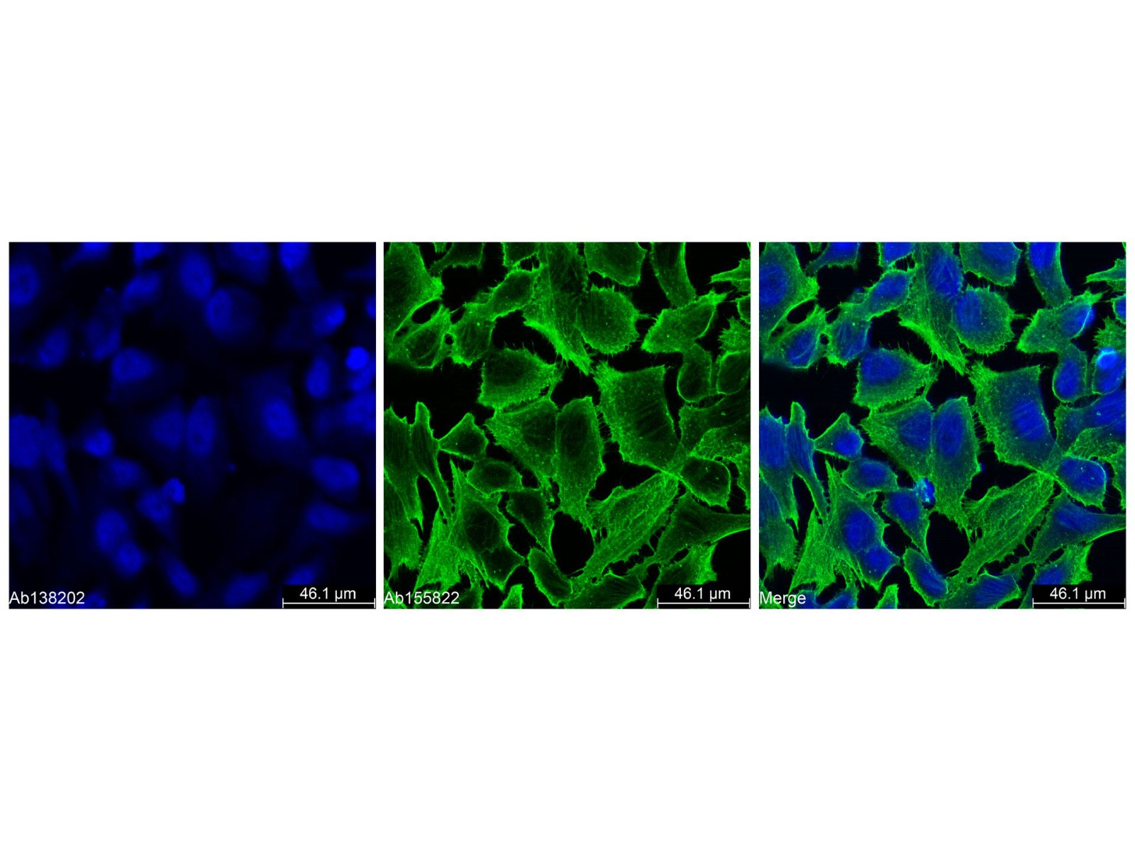 Goat Anti-Rabbit IgG H&L (AF405),ExactAb™, 高性能, 已验证, Ex:401nm, Em:422nm, 1.0 mg/mL,阿拉丁