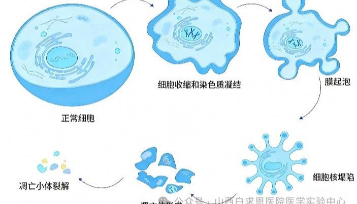流式细胞术检测细胞凋亡常用方法、原理及实验操作要点综述